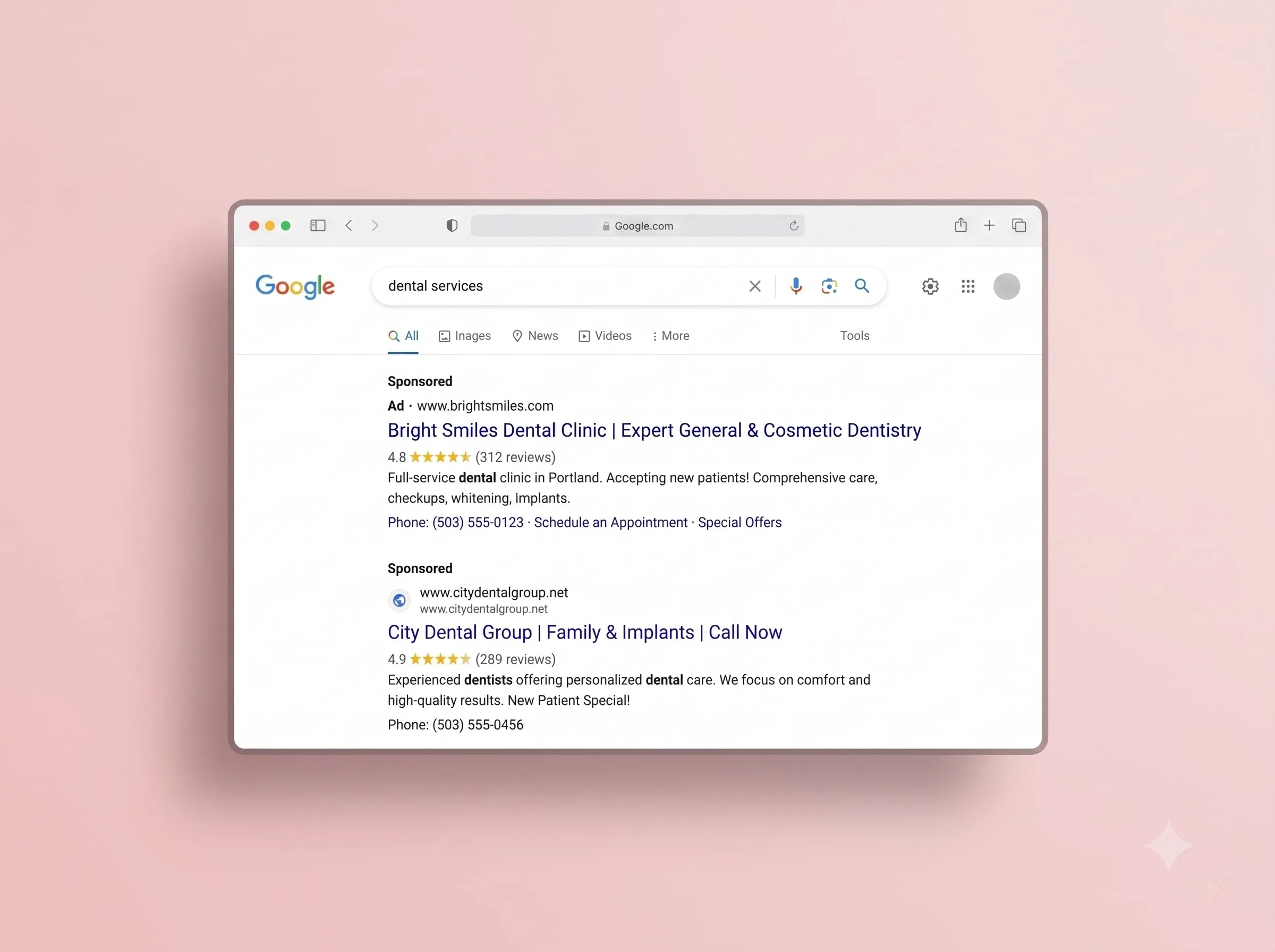 Google Patient Ads for Dentists