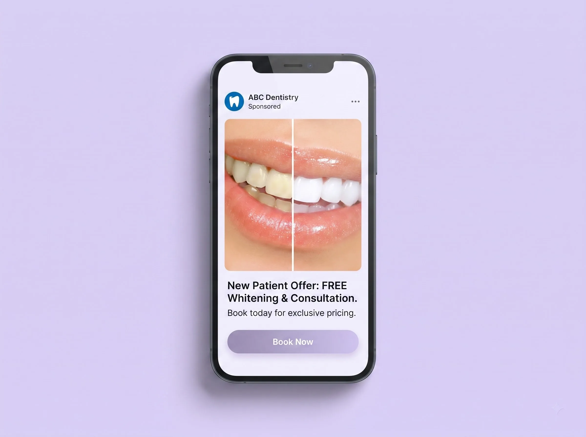 Meta Patient Ads for Dentists